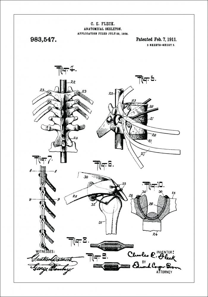 Patentzeichnung - Anatomisches Skelett III Poster